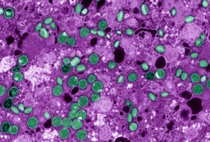 Several circular and elliptical virus particles dotted around a magenta, dark purple, and white background of infected cells.